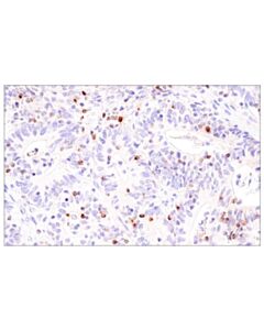 Cell Signaling Ccl5/Rantes (E9s2k) Rabbit mAb