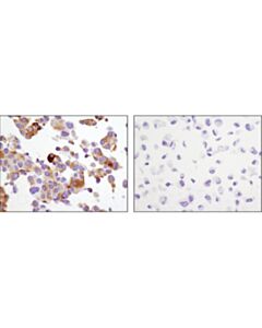 Cell Signaling Psa/Klk3 (D11e1) Xp ® Rabbit mAb (BSA And Azide Free)