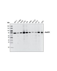 Cell Signaling Acecs1 (D19c6) Rabbit mAb