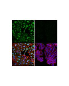 Cell Signaling Glucocorticoid Receptor (D8h2) Xp<LT/>Sup&Gt;®<LT/>/Sup&Gt; Rabbit mAb