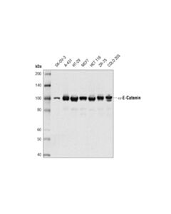 Cell Signaling Alpha-E-Catenin (D9r5e) Rabbit mAb