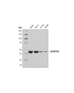 Cell Signaling Aldh1a1 (D9j7r) Xp Rabbit mAb