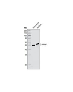 Cell Signaling Gfap (Ga5) Mouse mAb