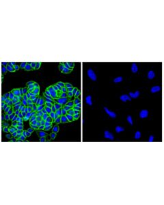 Cell Signaling Epcam (D4k8r) Xp Rabbit mAb