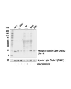 Cell Signaling Phospho-Myosin Light Chain 2 (Ser19) Mouse mAb 20 uL