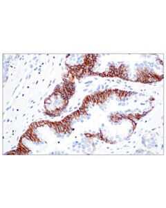 Cell Signaling CD44 v5 (C44Mab-3) Mouse mAb