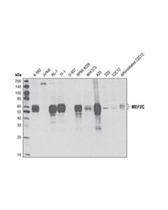 Cell Signaling Late-Onset Alzheimers Disease Risk Gene Antibody Sampler Kit