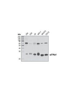 Cell Signaling p27 Kip1 (D37H1) Rabbit mAb 20 uL