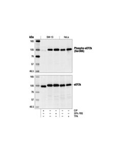 Cell Signaling Phospho-Eef2k (Ser366) Antibody