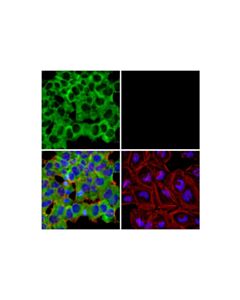 Cell Signaling Lin28a (D84c11) Xp ® Rabbit mAb