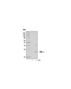 Cell Signaling Tnf-Alpha Antibody