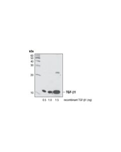 Cell Signaling TGF-beta (56E4) Rabbit mAb 20 uL