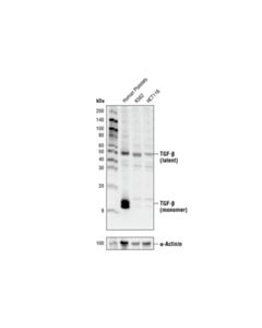 Cell Signaling Tgf-Beta Antibody