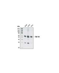 Cell Signaling Tnf-R1 (C25c1) Rabbit mAb
