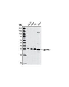 Cell Signaling Cyclin D2 (D52f9) Rabbit mAb