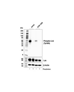 Cell Signaling Phospho-Lck (Tyr505) (E3z5e) Rabbit mAb