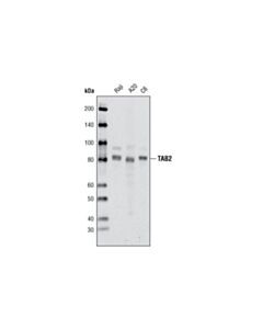 Cell Signaling TAB2 (C88H10) Rabbit mAb 20 uL