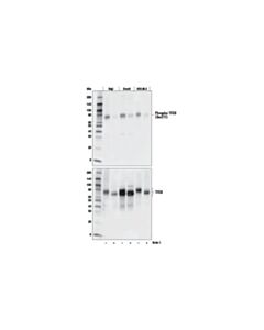 Cell Signaling Phospho-Tfeb (Ser211) (E9s8n) Rabbit mAb