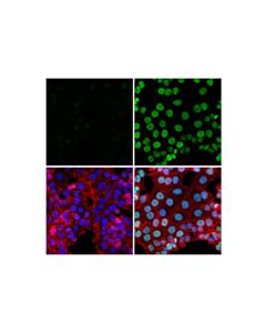 Cell Signaling Ubiquityl-Histone H3 (Lys18) (E4d7r) Rabbit mAb