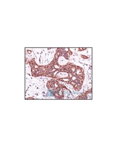 Cell Signaling Phospho-Akt (Ser473) (736e11) Rabbit mAb