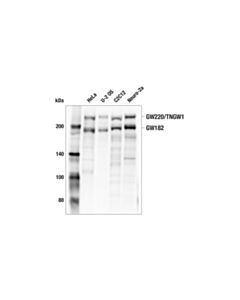 Cell Signaling Gw182 (E4c7j) Rabbit mAb