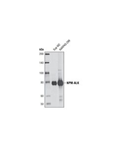 Cell Signaling ALK (31F12) Mouse mAb 20 uL