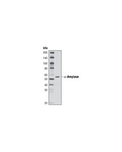Cell Signaling Alpha-Amylase (D55h10) Xp Rabbit mAb