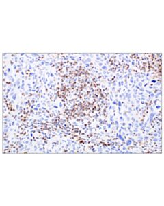 Cell Signaling CD3delta (PS1) Mouse mAb