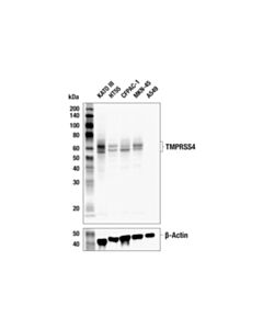Cell Signaling TMPRSS4 (E5F4W) Rabbit mAb (BSA and Azide Free)