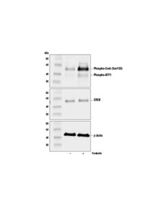 Cell Signaling Forskolin