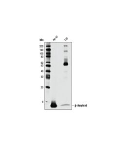 Cell Signaling Beta-Amyloid (D54d2) Rabbit mAb (BSA And Azide Free)