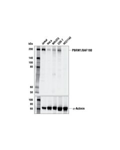 Cell Signaling Pbrm1/Baf180 (D4l9x) Rabbit mAb