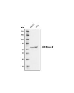 Cell Signaling Limk2 (8c11) Rabbit mAb