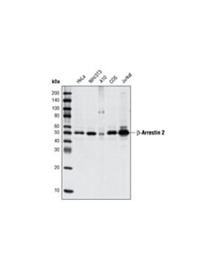 Cell Signaling beta-Arrestin 2 (C16D9) Rabbit mAb 20 uL