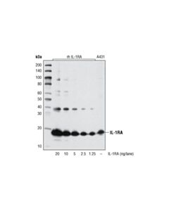 Cell Signaling IL-1RA (20D8) Mouse mAb 20 uL