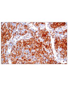 Cell Signaling Cd28 (D2z4e) Rabbit mAb