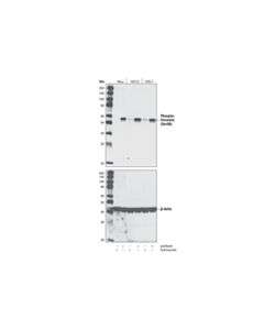 Cell Signaling Phospho-Vimentin (Ser56) Antibody