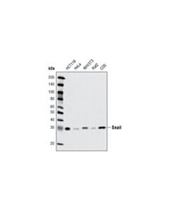 Cell Signaling Snail (C15d3) Rabbit mAb