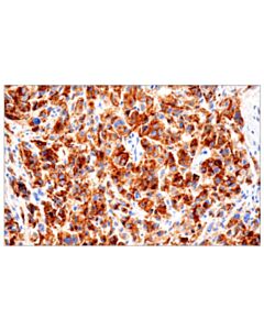 Cell Signaling PMEL/Melanoma gp100 (HMB45) Mouse mAb