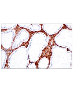 Cell Signaling Hyaluronan Complete Tissue Staining Kit (HRP)