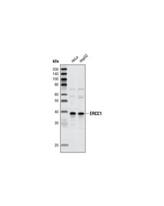 Cell Signaling Ercc1 Antibody
