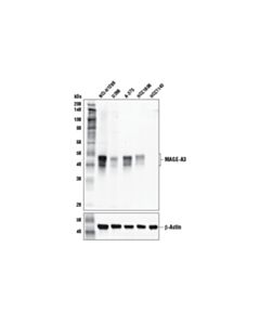 Cell Signaling MAGE-A3 (E9S4X) Rabbit mAb 20 uL