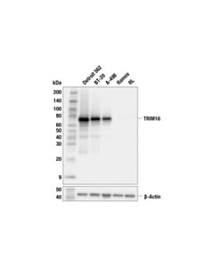 Cell Signaling TRIM16 (F3S3I) Rabbit mAb; 20 µl