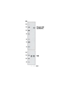 Cell Signaling Human Brain-Derived Neurotrophic Factor (Bdnf)