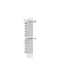 Cell Signaling Bcr-Abl (b2a2 Junction Specific) (L99H4) Mouse mAb 20 uL