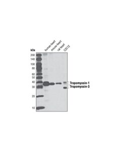 Cell Signaling Tropomyosin-1/3 (D17B8) Rabbit mAb 20 uL