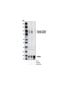 Cell Signaling Phospho-Psd95 (Tyr236/Tyr240) Antibody