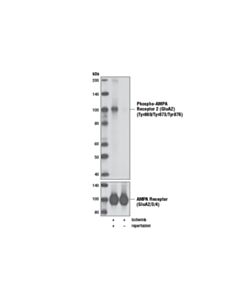 Cell Signaling Phospho-Ampa Receptor 2 (Glua2) (Tyr869/Tyr873/Tyr876) Antibody