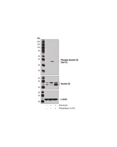 Cell Signaling Phospho-Keratin 20 (Ser13) (D9M6O) Rabbit mAb 20 uL