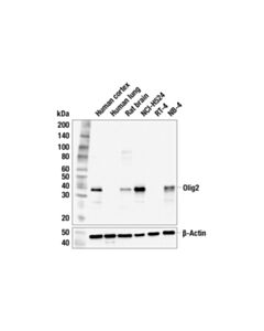 Cell Signaling Olig2 (F9R1H) Mouse mAb